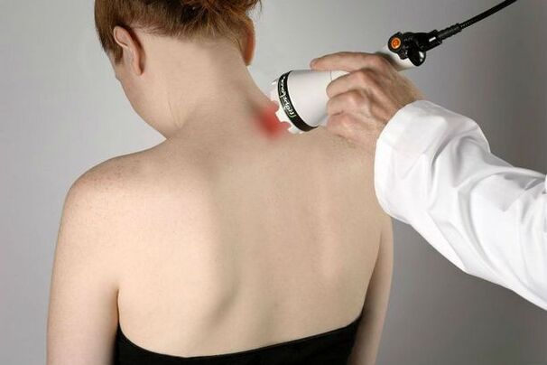 Servikal osteokondrozun tedavisi için fizyoterapötik önlemler