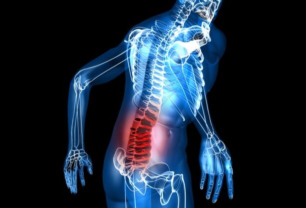 lomber osteokondroz nedir