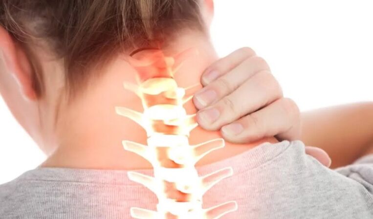 Osteokondroz I derecesi